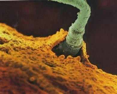 润滑剂及阴道栓剂也可能减少怀孕的机会