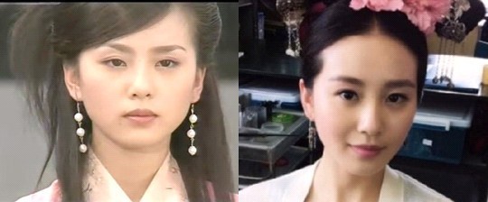 瘦脸针和削骨这两种手术有区别吗?