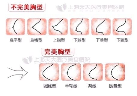 从a到d隆胸的变化
