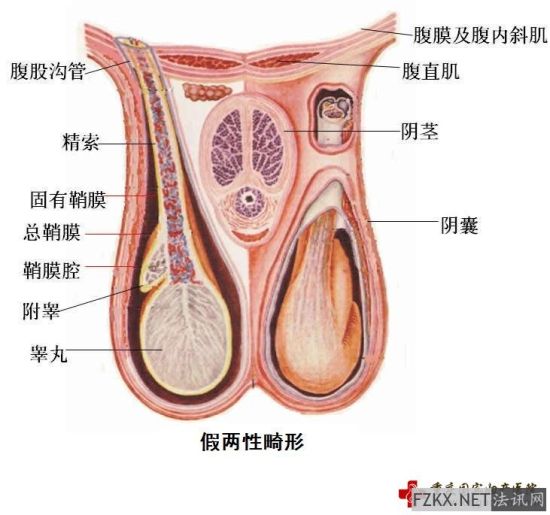两性畸形:外表<em>美女</em>老师 <em>身体</em>纯爷儿们(图)_新浪