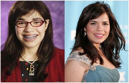 “丑女贝蒂”抛去眼镜钢牙套 为牙齿投保1000万美元保险_新浪上海_新浪网