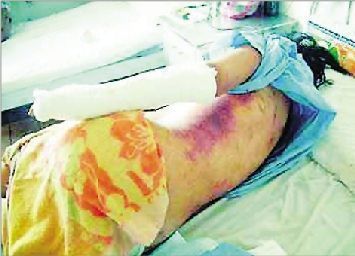 深圳性奴案女子系主动求<em>性虐</em>玩过火(6)_新浪