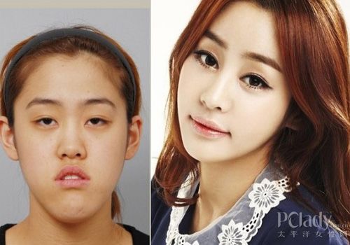 <em>假脸姐妹团</em>整形支招:双眼皮、去眼袋等_美容