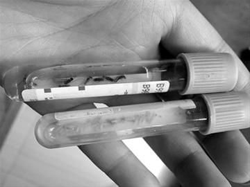 防治人员将白蚁装进试管 防治人员将白蚁装进试管