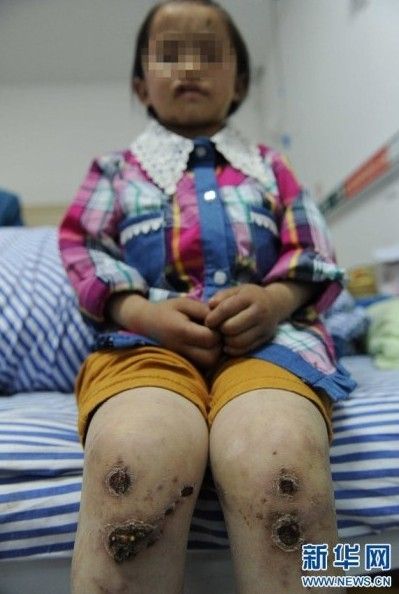 男子虐待<em>女儿</em>5年 开水烫头鱼线缝嘴_新浪上海
