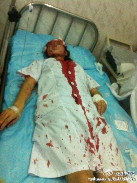 湖南怀孕护士_怀孕护士为患者翻身_西安护士