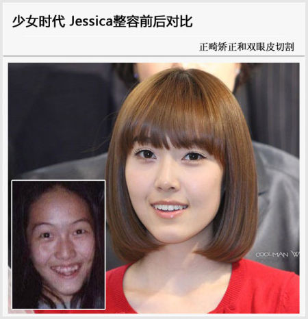 少女时代<em>整容前后</em>对比曝光 Sunny和<em>Jessica</em>_情
