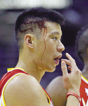 林书豪受伤 离场4分钟(图)