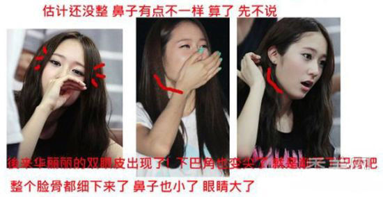 《继承者们》主演<em>整容前后</em>照曝光 郑秀晶_情感