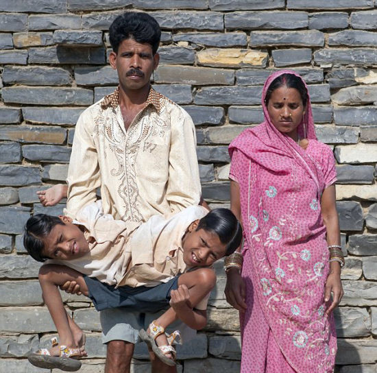 印度连体兄弟被奉神灵(组图)(4)