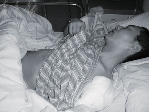 苏醒后,包长亮发现自己孤零零地躺在重症病房,身上裹满了渗着血的纱布