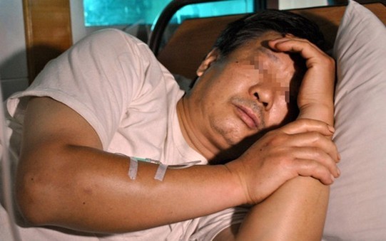 被割掉下体的男子在医院接受治疗 被割掉下体的男子在医院接受治疗