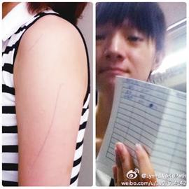 乞讨者“报复”在手臂上划两道圆珠笔印 乞讨者“报复”在手臂上划两道圆珠笔印