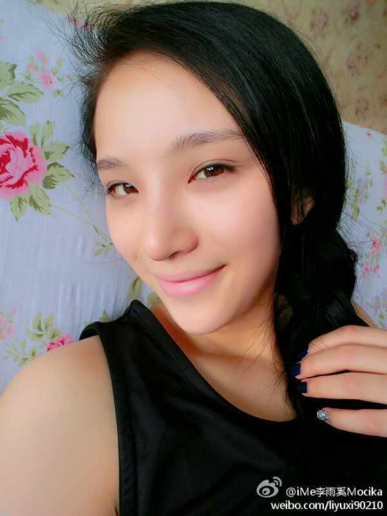 快女整容成畸形锥子脸 李媛希整成李雨奚(6)