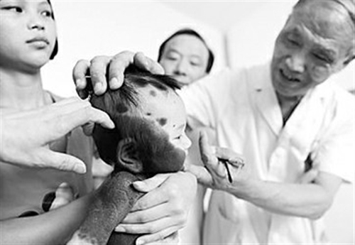 福建<em>熊猫女婴</em>来沪求医 多家医院专家联合会诊