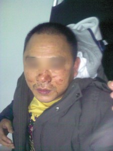 宝山城管与3名残疾小贩起冲突致一人肋骨骨折