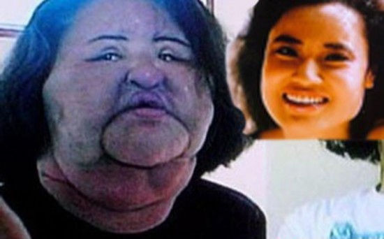 美国前av女优隆胸梦碎 挺"大小胸"15年(2)