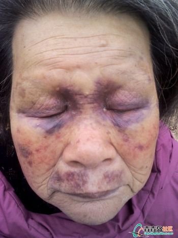 8旬老太遭毒打灌尿 毫无人性(2)